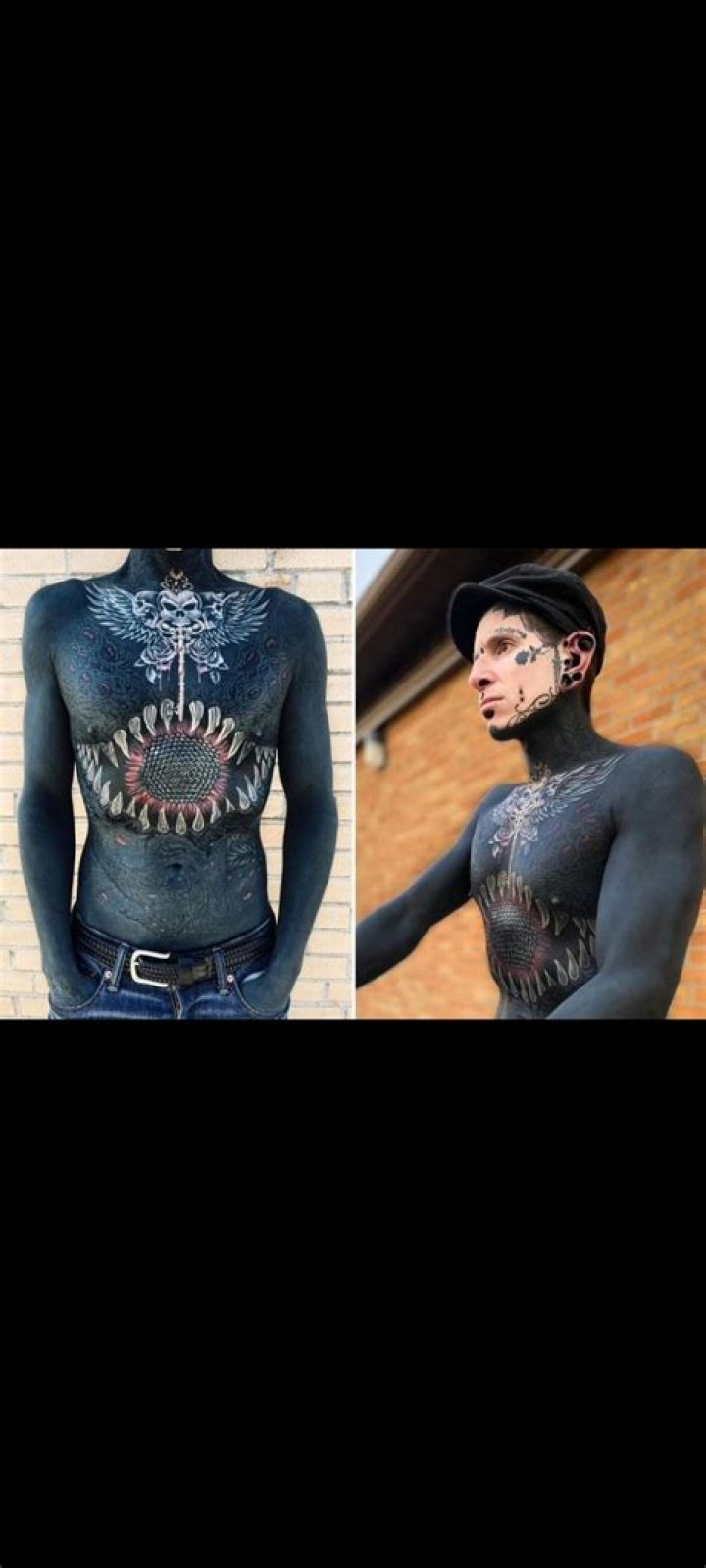 Adam Curlykale Tattooed His Whole Body, Then Removed His Genitals And Nipples