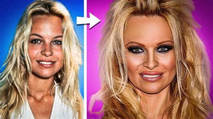 Has Pamela Anderson Gotten Plastic Surgery? See the ‘Baywatch’ Alum Then and Now!