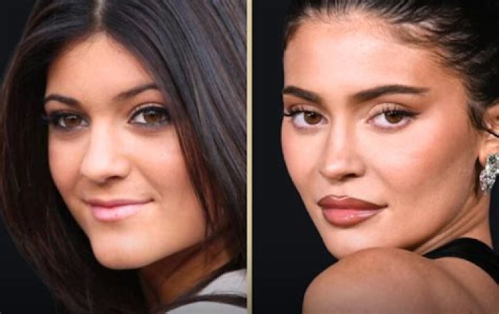 Kylie Jenner Looks Nothing Like Kylie Jenner When She Cracks an Authentic Smile…