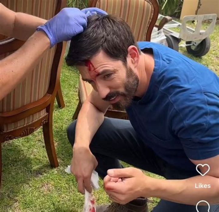 Property Brothers Star Drew Scotty head Injury while filming Celebrity IOU