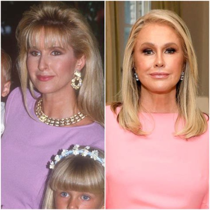 ‘RHOBH’ Newbie Kathy Hilton’s Transformation Is Fierce — But Has She Gotten Plastic Surgery?