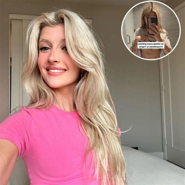 Sami Sheen Gets a Boob Job and Says the Implants Feel Like They’re Going to ‘Rip Off’