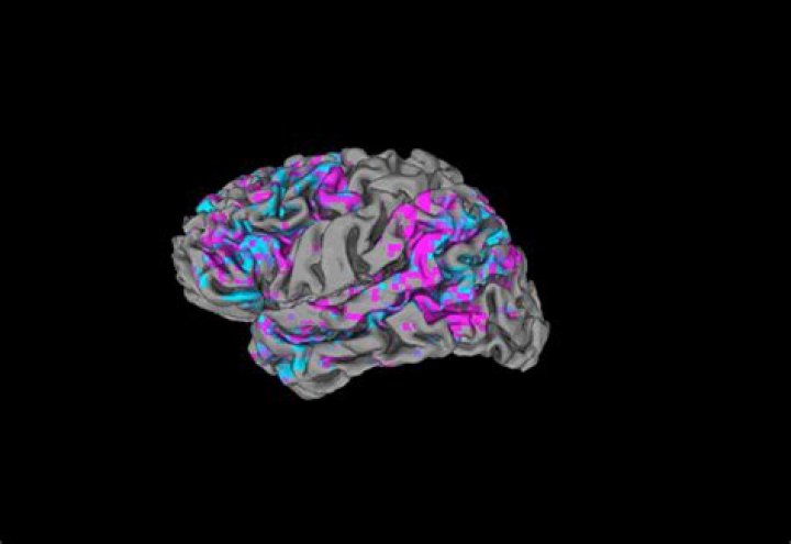 Scientists Develop AI Brain Decoder To Turn Thoughts Into Text