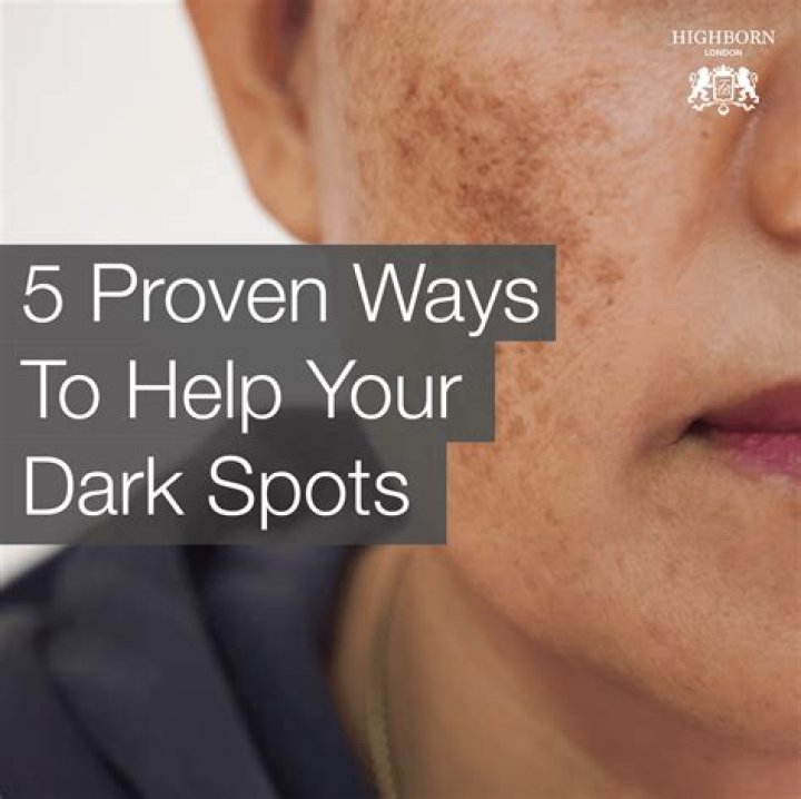 Skin Check-In With Dr. Will: 10 Top Dermatologists Reveal How to Get Rid of Pesky Dark Spots