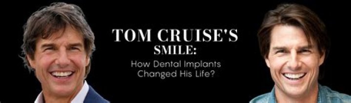 Tom Cruise’s Smile Is Not as Perfect as It Seems Because of This One Thing