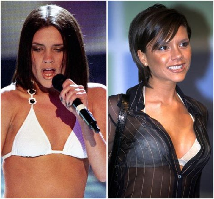 Victoria Beckham Reveals Boob Job Regrets — Plus More Celeb Plastic Surgery Confessions!