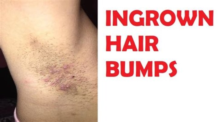 Wait — WHAT?!Dyeing Armpit Hair is Apparently a Thing Now